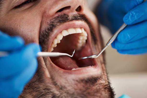 Best Urgent Dental Care for Toothache in Onalaska, WI